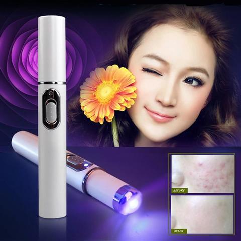 Blue light pen features